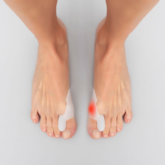 Silicone Bunion Corrector Protector Bunilief InnovaGoods 2 Units
